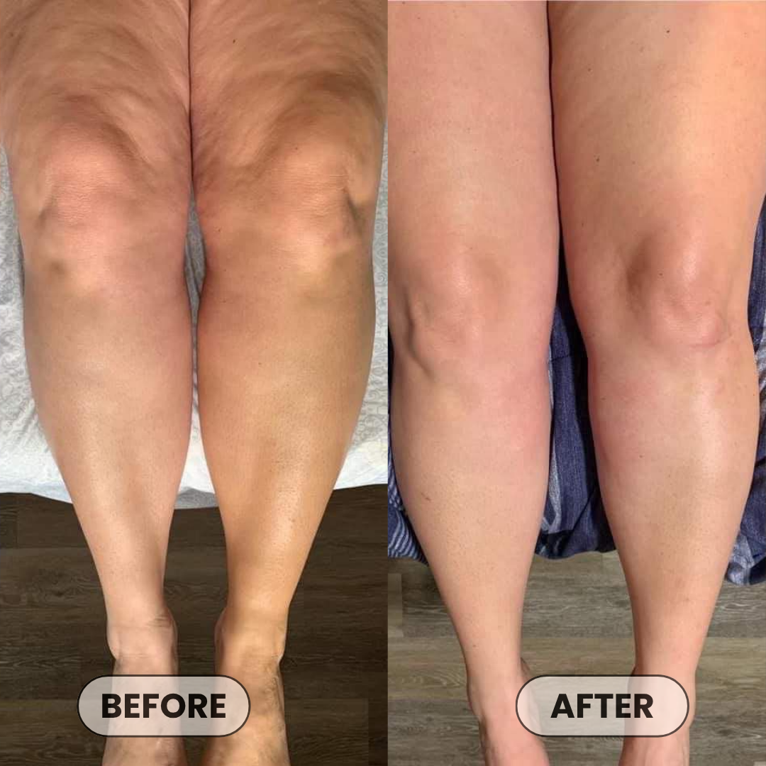 Anti-Cellulite Massage Oil