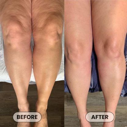 Anti-Cellulite Massage Oil