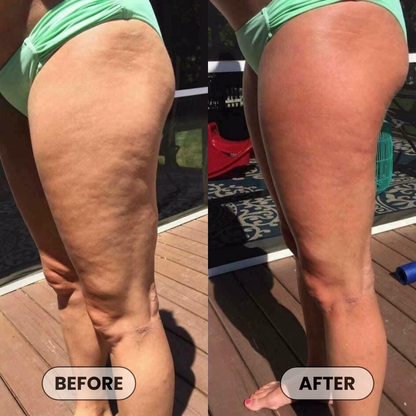 Anti-Cellulite Massage Oil